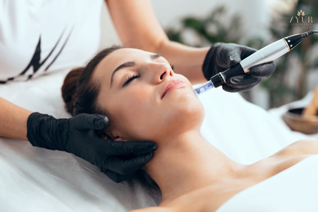 Microneedling-ayuraesthetics,Missouri city