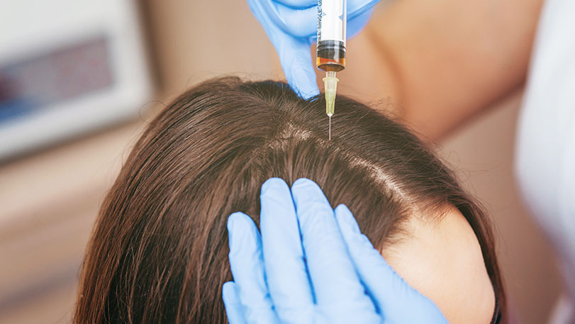 Hair Restoration Treatment-Ayur Aesthetics,Missouri City