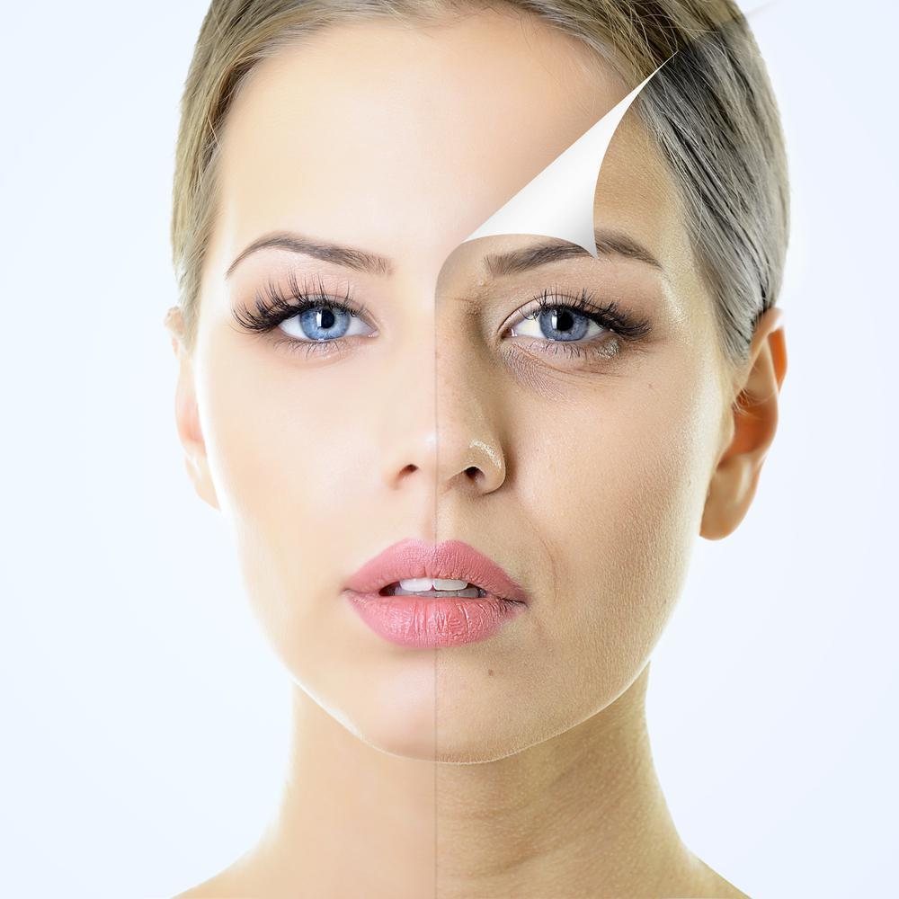 Dermal Fillers-Ayur Aesthetics-Missouri City