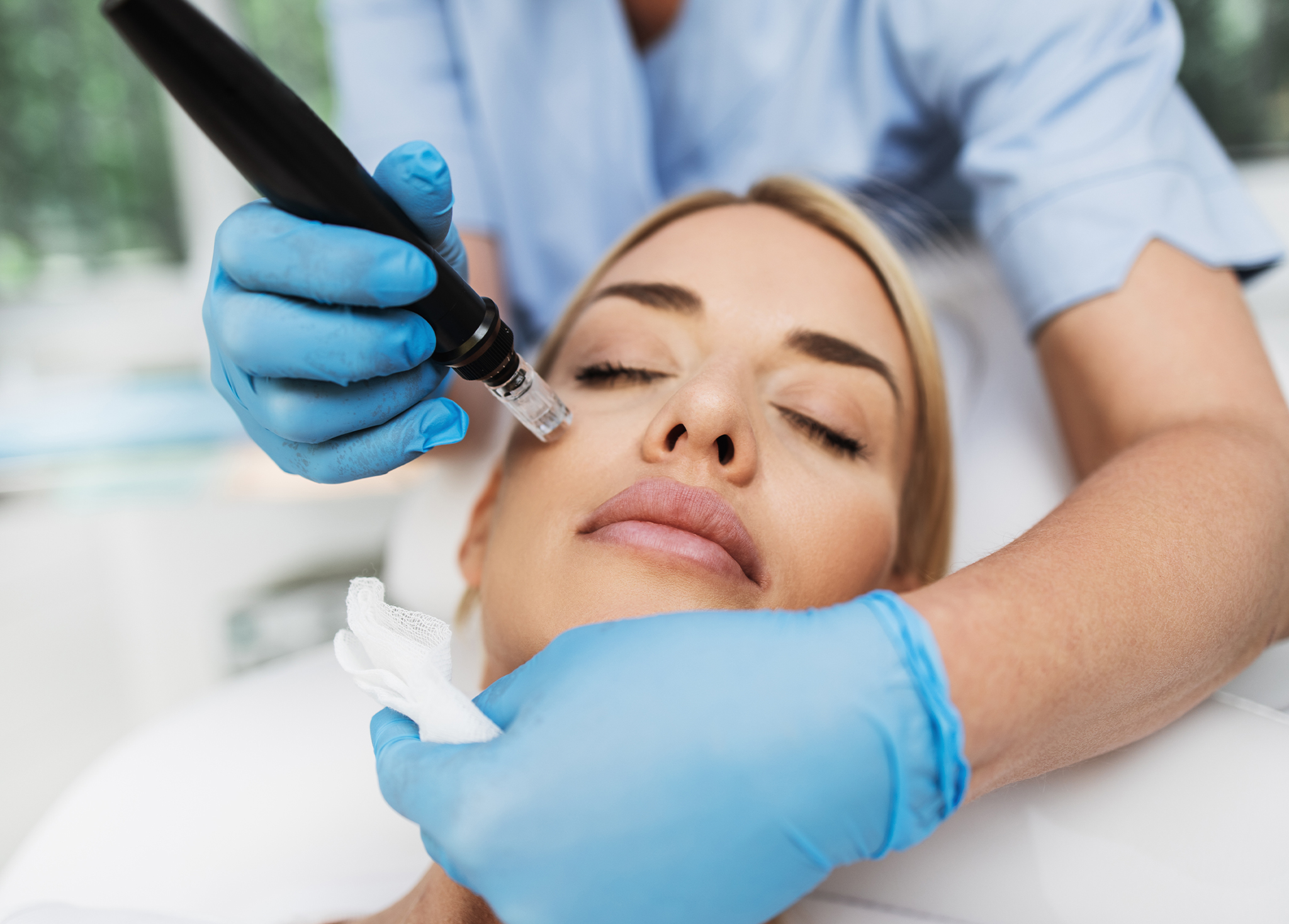 skin-care-after-microneedling