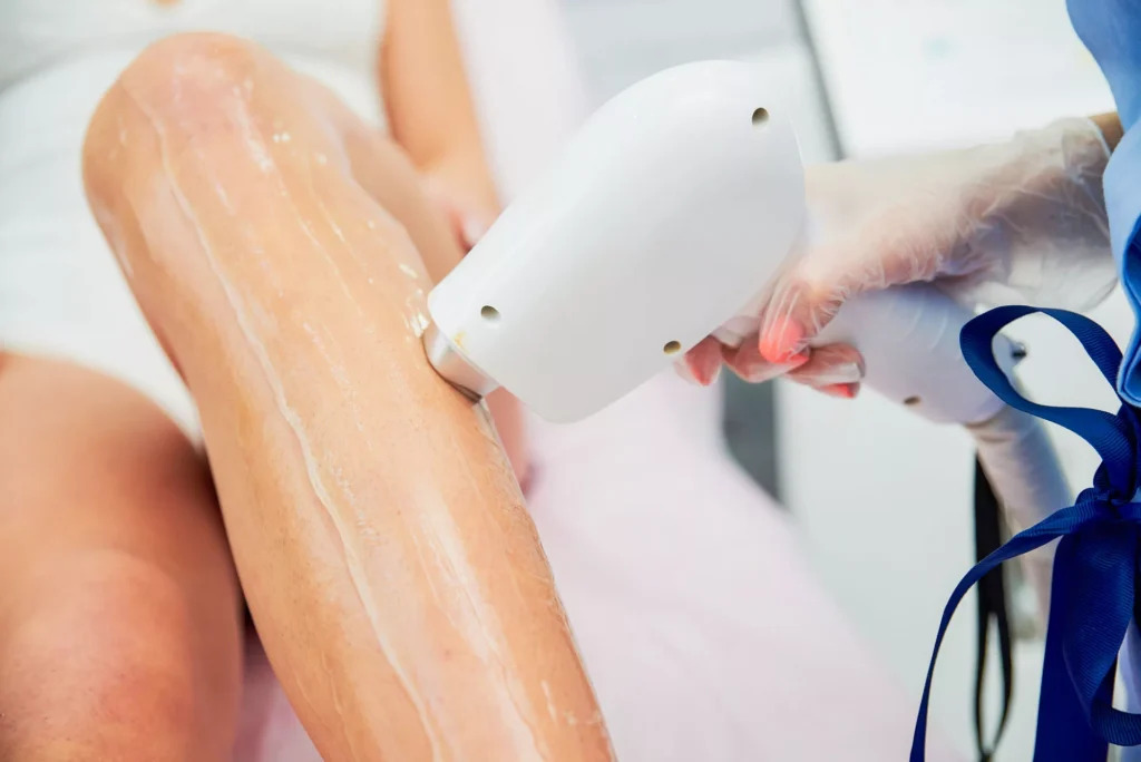 Laser Hair Removal -ayuraesthetics, Missouri city